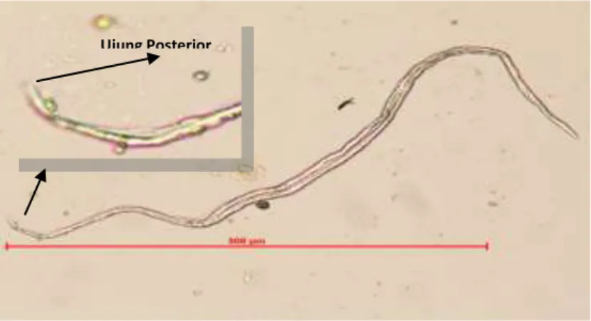 Gambar 10 Larva cacing S. papilosus (perb 20x)   (Nezar/Dok. Nezar 2014) 