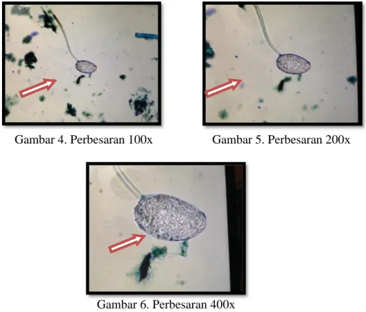Gambar 6. Perbesaran 400x 