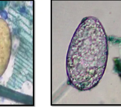 Gambar 8. A) Telur Fasciola sp. (Anggriana,2014) dan B) Telur Paramphistomum sp.  