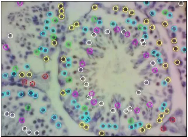 Gambar 3. Tampilan mikroskopis dari testis mencit tua kelompok kontrol dengan pembesaran 40x10