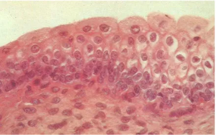 Gambar 1.9. Epitel transisional  v. urinaria (Craigmyle, 1986) 