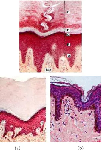 Gambar  1.10    Epitel  berlapis  (a)  kulit  tebal  dengan  stratum  lusidium,  (b)  kulit  tebal  tanpa  stratum  lusidium,  dan  (c)  kulit  tipis  tanpa  stratum  lusidium (Craigmyle, 1986) 
