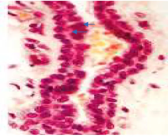 Gambar  1.11.  Epitel  burlapis  kubus  dari  saluran  laktiferus  kelenjar  mamae  (Craigmyle, 1986) 