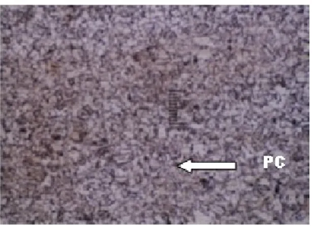Gambar 11.  Struktur mikro logam las kam- kam-puh V tunggal Etsa HNO 3  5%.