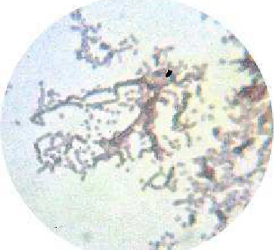 Gambar 1. Spora  Streptomyces sp. 