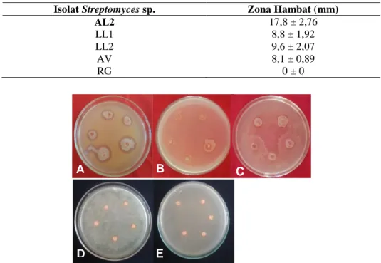 Tabel 1. Persentase Daya Hambat Streptomyces sp. terhadap Xanthomonas sp. secara in vitro 