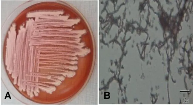 Gambar 2. A. Koloni Streptomyces sp. AL2 pada media YMA, B. Struktur mikroskopis Streptomyces  AL2 (Pembesaran 1000x) 