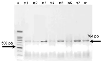 Gambar 2 Hasil elektroforesis pada gel agarose 
