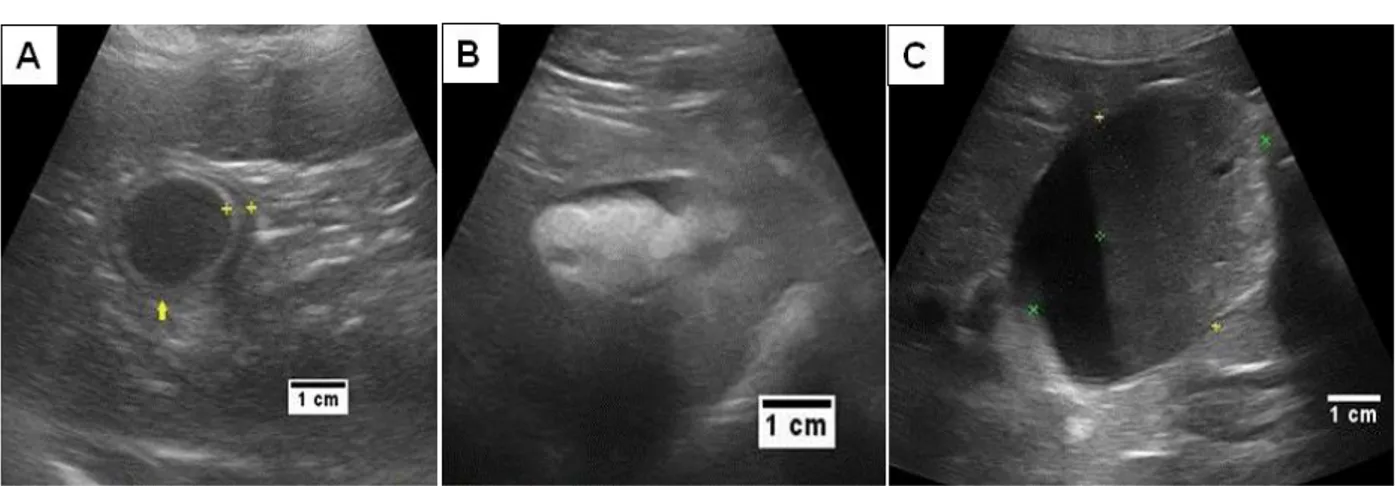 Gambar 2. (A) Sonogram kantung empedu pada kasus cholecystitis 1; (B) Sonogram kantung empedu pada kasus cholelithiasis  5; (C) Sonogram kantung empedu pada kasus mucocele 10.