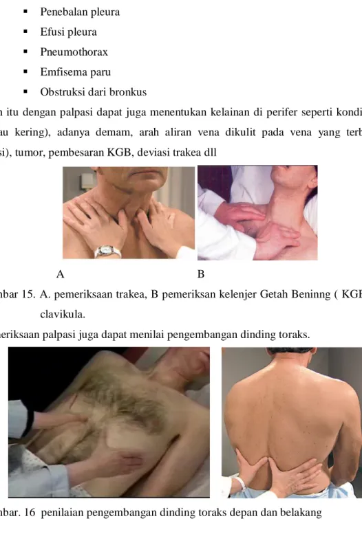 Gambar 15. A. pemeriksaan trakea, B pemeriksan kelenjer Getah Beninng ( KGB) supra  clavikula