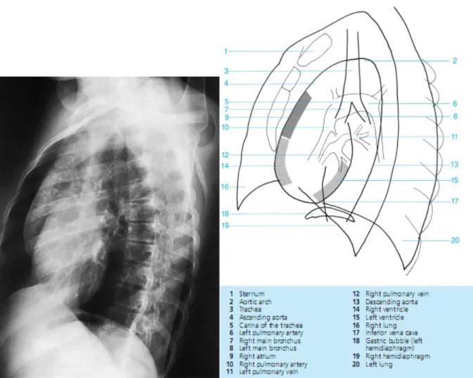 Gambar 11: Gambar Radiograph Dada Anterior Oblique  5