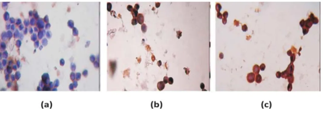 Gambar 3. Hasil imunositokimia ekspresi caspase-3 pada sel HeLa karena perlakuan selama 24 jam: (a) Kontrol tanpa perlakuan EPBJ, (b) EPBJ 4 mg/ml, dan (c) EPBJ 8 mg/ml
