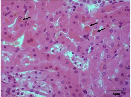 Gambar  8 Hyalin  droplet (panah)  di  epitel  tubuli  ginjal  pada  kelompok  KP.