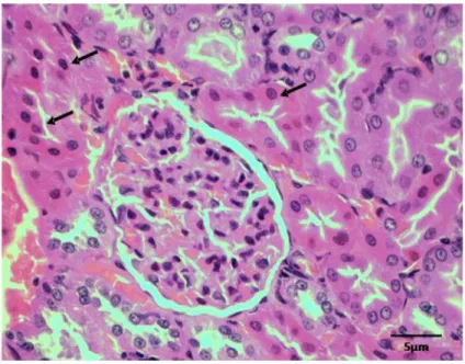 Gambar  9    Tubulus  nekrotik  dengan  inti  piknotis  (panah)  dan  sitoplasma  lebih eosinofilik pada kelompok E100