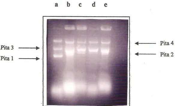 Gambar 2. Elektroforegram hasil uji aktivitas pemotongan DNA superkoil fraksi protein hasil pemurnian dengan kolom CM Sepharose CL-6B yang terikat fase diam