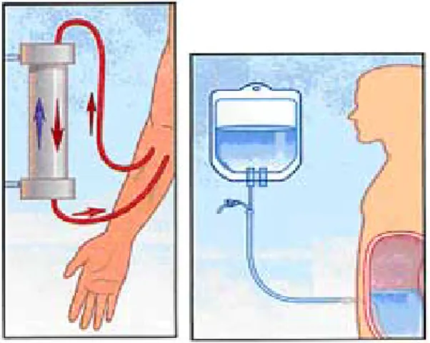 Gambar 5.Hemodialisis                           