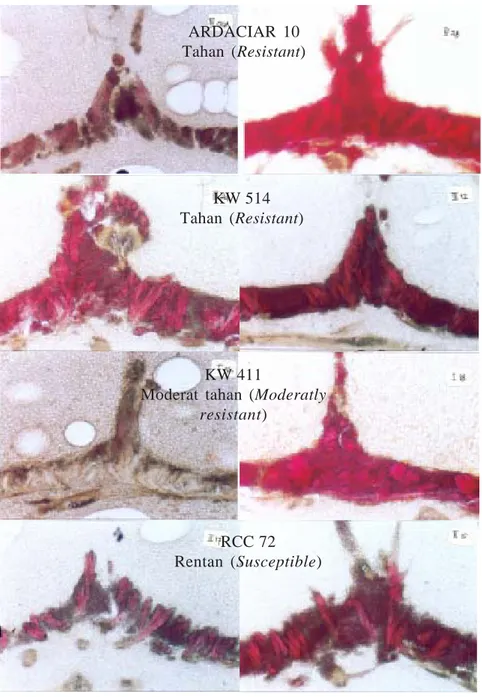 Gambar 5. Perbedaan  tingkat  lignifikasi dan kekompakan jaringan sklerotik buah di bagian alur pada buah muda (kiri) dan buah tua (kanan) beberapa klon kakao dengan respons ketahanan PBK berbeda (perbesaran 4 x 10) .