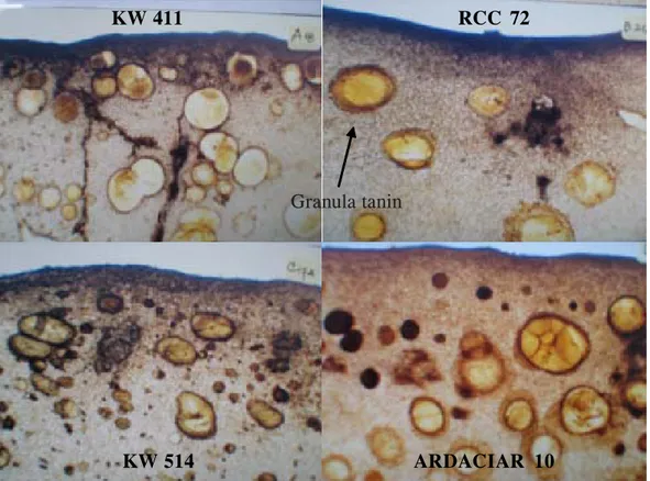 Gambar 3. Perbedaan keragaan granula tanin yang terdistribusi pada lapisan mesokarp buah muda beberapa klon kakao dengan respons ketahanan PBK yang berbeda (Perbesaran 4 x 10).