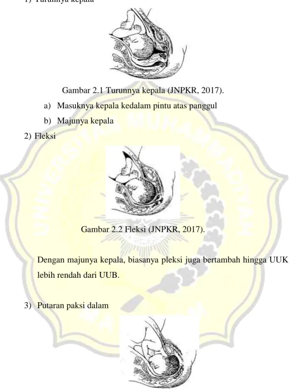Gambar 2.1 Turunnya kepala (JNPKR, 2017). 