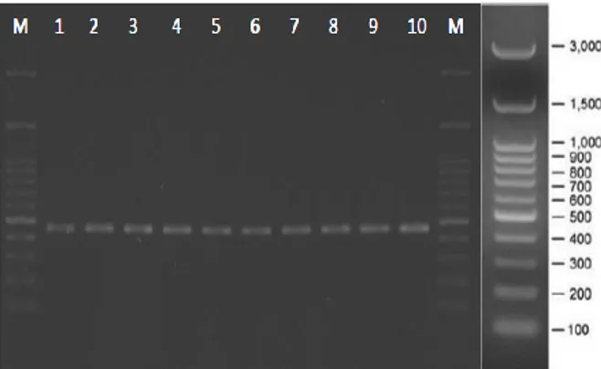 Gambar  2.  Gambaran  elektroforesis  amplifikasi  DNA  hasil  PCR  1%  dalam  gel  agarose