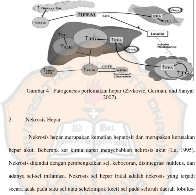 Gambar 4 : Patogenesis perlemakan hepar (Zivkovic, German, and Sanyal  2007). 