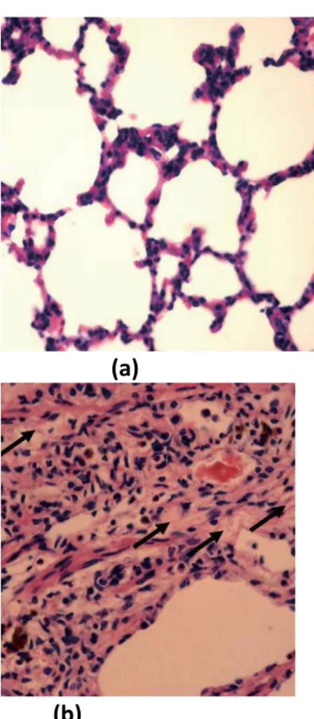 Gambar 1.Histopatologi paru (a) paru  normal (b) paru yang telah mengalami 