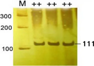 Gambar   2  Hasil   pemotongan   amplikon   gen  BMPR-IB oleh  AvaII (M= marker 100  pb,   --   =   homozigot   tipe   liar,   B-= 