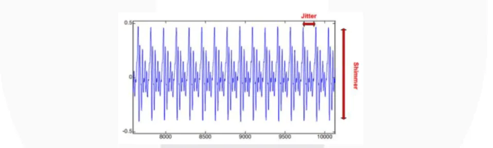 Gambar 4 Representasi Jitter, Shimmer yang Terukur pada Sinyal Suara [6] 