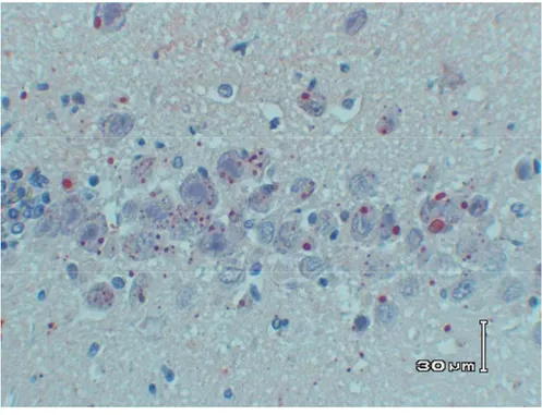 Gambar 2.  Otak besar dengan inti sel neuron berwarna biru tua dan sitoplasma biru muda