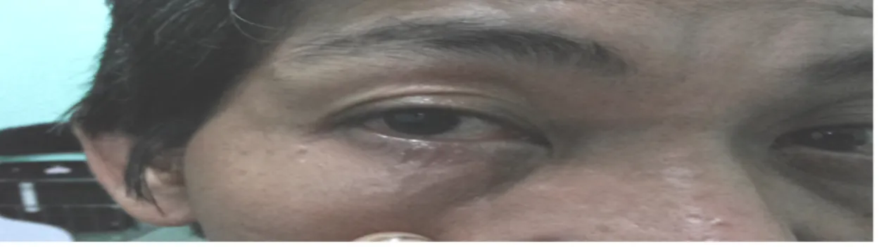Gambar	2.	Okuli	Dextra. 	