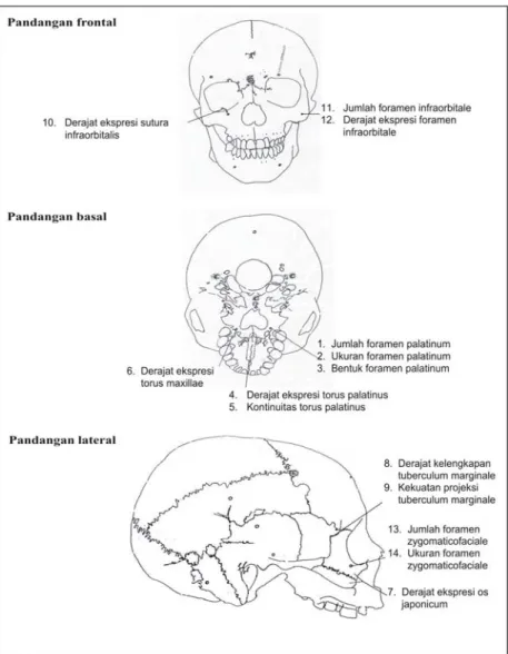 Gambar 2.  Karakteristik-karakteristik epigenetis upper  viscerocranium yang diteliti dalam pandangan  frontal, basal dan lateral 