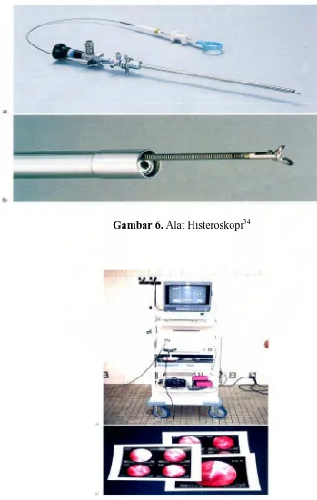 Gambar 6. Alat Histeroskopi34 
