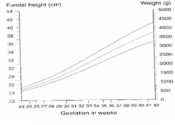 Gambar 3. Grafik hubungan tinggi fundus uteri terhadap usia kehamilan dan berat 