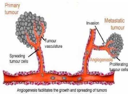Gambar 2.6.  Pengaruh Angiogenesis dan Metastase Tumor  Dkutip dari 43 