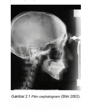 Gambar 2.1 Film cephalogram (Shin 2002). 