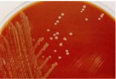 Gambar 4. Kultur bakteri Neisseria gonorrhoeae  c.  Tes Definitif 