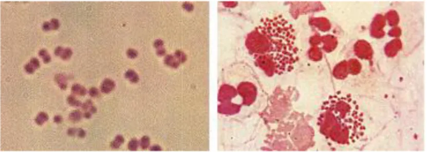 Gambar 2. Pengecatan gram kuman Neisseria gonorrhoeae 22