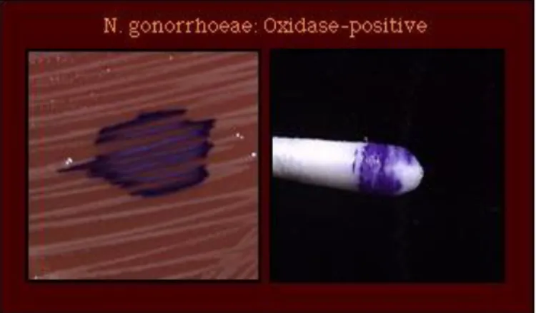 Gambar 3. Oksidase Positif pada Neisseria gonorrhoeae 24