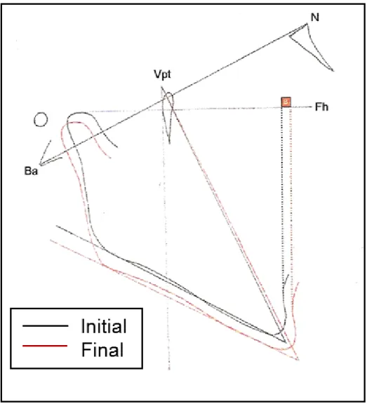 Fig. 2. Type of cephalometric superimposition of the initial and final  x-rays in both groups in the Ba-N plane, using the Cc as the fixed point 