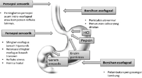 Gambar 1. Etiopatogenesis terjadinya GERD. 11,12