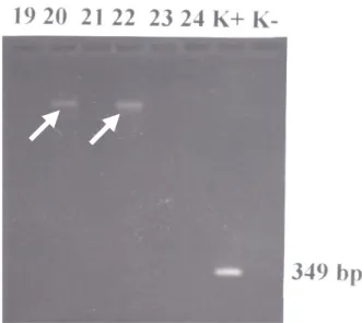 Gambar 3. Hasil analisis PCR terhadap gen cagA(1) (produk berukuran 349 base-pair)  dimana sampel nomor 20 dan 22 (MIU positif) menunjukkan band non spesifik (anak 