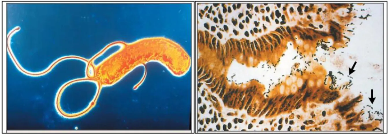 Gambar 1. Helicobacter pylori  Gambar 2. Spesimen biopsi gaster 