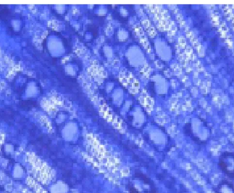 Gambar 1. Hifa Oncobasidium theobromae meninfeksi xilem, diwarnai dengan  lactophenol cotton blue 
