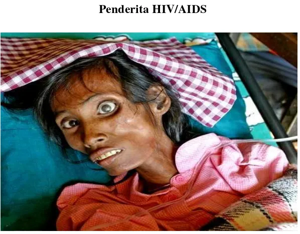 Gambar 1.1Penderita HIV/AIDS