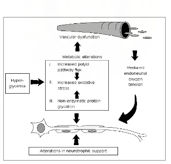 Gambar 1. Patogenesis neuropati diabetik. dikutip dari 19 