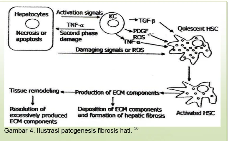 Gambar-4. Ilustrasi patogenesis fibrosis hati. 30 