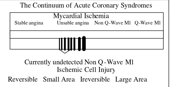Gambar 2. Continuum dari sindroma koroner akut  