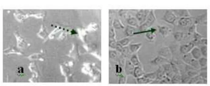 Gambar 4. Morfologi sel T47D akibat perlakuan EP 60 µg/mL (a) dibandingka dengan sel  tanpa perlakuan/kontrol sel (b)
