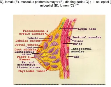 Gambar 1.  Anatomi payudara. I. Duktus (A), lobulus (B), sinus laktiferous (C), puting susu (D), lemak (E), muskulus pektoralis mayor (F), dinding dada (G) ;  II