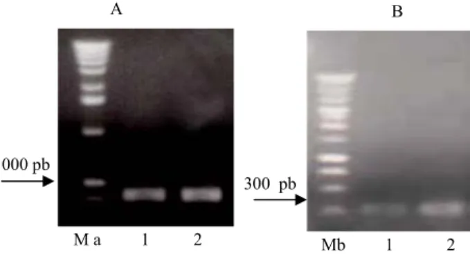 Figure 4    Electrophoretic profile of  the PCR  product  for 5’flanking EGAD1(A) using  primer pair 5EGD-11F/11R; 